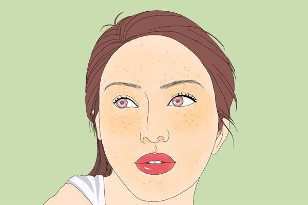 满脸雀斑还能美出高级俏皮感?我信你个鬼!